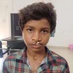 सफलता की कहानी: ‘चिरायु’ दल ने जन्मजात कटे होंठ और तालु से दिलाई मुक्ति